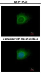 Anti-Caspase 10 antibody used in Immunocytochemistry/ Immunofluorescence (ICC/IF). GTX113148