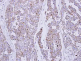 Anti-Catalase antibody [N2C1], Internal used in IHC (Paraffin sections) (IHC-P). GTX113149