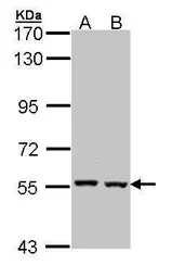 Anti-Catalase antibody [N2C1], Internal used in Western Blot (WB). GTX113149