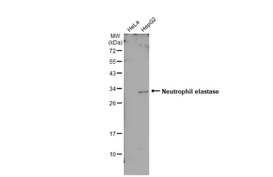 Anti-Neutrophil elastase antibody [N2C3] used in Western Blot (WB). GTX113175