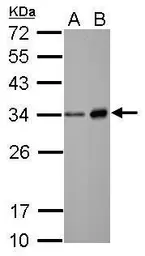 Anti-Neutrophil elastase antibody [N2C3] used in Western Blot (WB). GTX113175