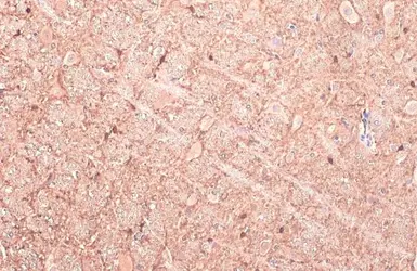 Anti-GAD67 antibody used in IHC (Paraffin sections) (IHC-P). GTX113190