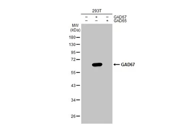 Anti-GAD67 antibody used in Western Blot (WB). GTX113190