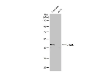 Anti-GNAS antibody [C2C3-2], C-term used in Western Blot (WB). GTX113200