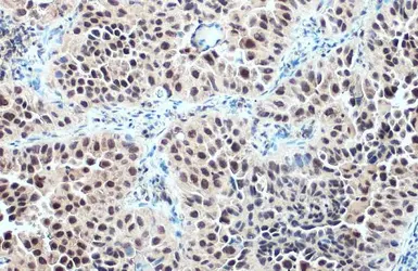 Anti-Glucocorticoid Receptor antibody used in IHC (Paraffin sections) (IHC-P). GTX113208