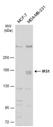 Anti-IRS1 antibody [C2C3], C-term used in Western Blot (WB). GTX113213