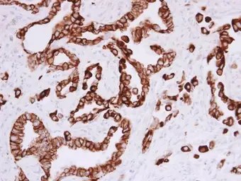 Anti-Cytokeratin 5 antibody used in IHC (Paraffin sections) (IHC-P). GTX113219