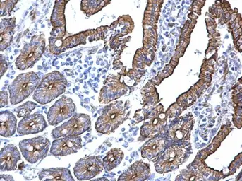 Anti-Cytokeratin 5 antibody used in IHC (Paraffin sections) (IHC-P). GTX113219