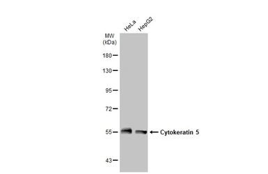 Anti-Cytokeratin 5 antibody used in Western Blot (WB). GTX113219