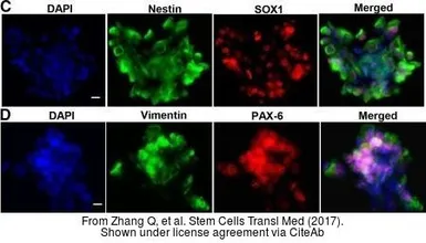 Anti-PAX6 antibody used in Immunocytochemistry/ Immunofluorescence (ICC/IF). GTX113241