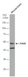 Anti-PAX6 antibody used in Western Blot (WB). GTX113241
