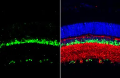 Anti-PAX6 antibody used in IHC (Paraffin sections) (IHC-P). GTX113241
