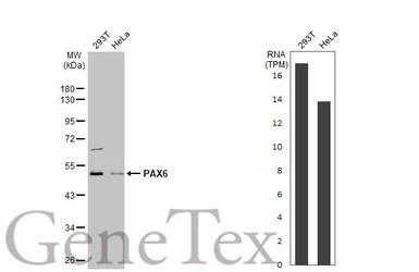 Anti-PAX6 antibody used in Western Blot (WB). GTX113241
