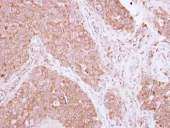 Anti-SIAH1 antibody used in IHC (Paraffin sections) (IHC-P). GTX113268