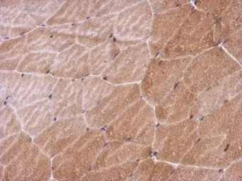Anti-Thymidine Kinase 1 antibody used in IHC (Paraffin sections) (IHC-P). GTX113281