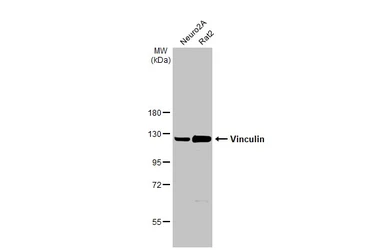 Anti-Vinculin antibody [N1N3] used in Western Blot (WB). GTX113294