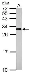 Anti-14-3-3 gamma antibody used in Western Blot (WB). GTX113298