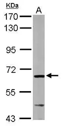Anti-AIF antibody [N1C1] used in Western Blot (WB). GTX113306