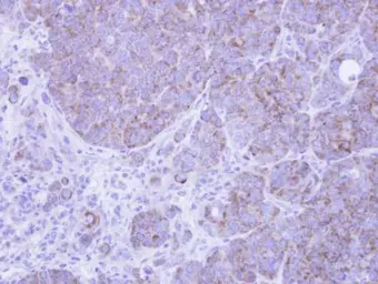 Anti-AIF antibody [N1C1] used in IHC (Paraffin sections) (IHC-P). GTX113306