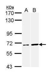 Anti-AIF antibody [N1C1] used in Western Blot (WB). GTX113306