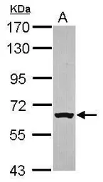 Anti-RACGAP1 antibody [C1C3] used in Western Blot (WB). GTX113322