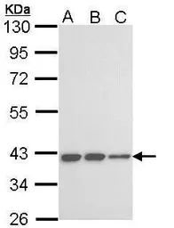 Anti-KIR3DL2 antibody used in Western Blot (WB). GTX113369