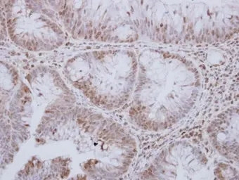 Anti-MST3 antibody [N2C1], Internal used in IHC (Paraffin sections) (IHC-P). GTX113371