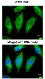Anti-MST3 antibody [N2C1], Internal used in Immunocytochemistry/ Immunofluorescence (ICC/IF). GTX113371
