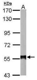Anti-ALDH2 antibody [N1C1] used in Western Blot (WB). GTX113379