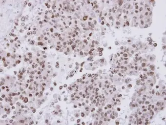Anti-FANCA antibody [N1], N-term used in IHC (Paraffin sections) (IHC-P). GTX113433