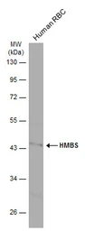 Anti-HMBS antibody [N2C3] used in Western Blot (WB). GTX113460