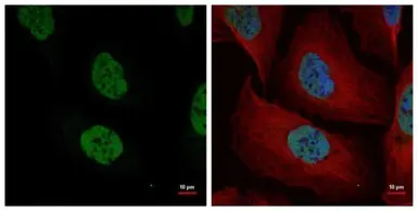 Anti-NuMA antibody [N1], N-term used in Immunocytochemistry/ Immunofluorescence (ICC/IF). GTX113510