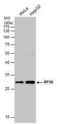 Anti-RPS6 antibody used in Western Blot (WB). GTX113542