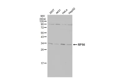 Anti-RPS6 antibody used in Western Blot (WB). GTX113542