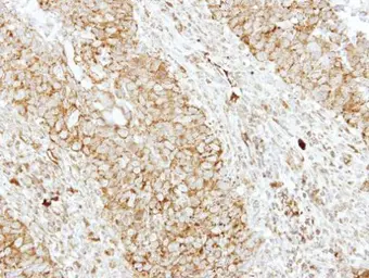 Anti-SH3GL1 antibody [N3C3] used in IHC (Paraffin sections) (IHC-P). GTX113548