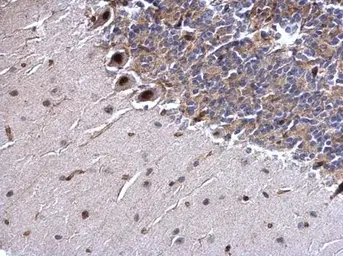 Anti-SSB antibody used in IHC (Paraffin sections) (IHC-P). GTX113555