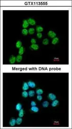 Anti-SSB antibody used in Immunocytochemistry/ Immunofluorescence (ICC/IF). GTX113555