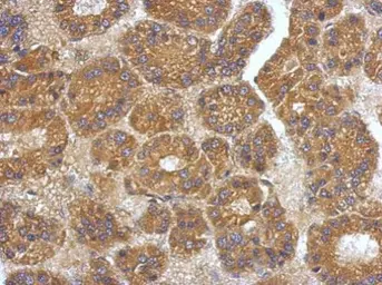 Anti-VEGFC antibody used in IHC (Paraffin sections) (IHC-P). GTX113574