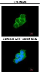 Anti-14-3-3 epsilon antibody [N2C3] used in Immunocytochemistry/ Immunofluorescence (ICC/IF). GTX113576