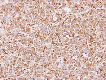 Anti-14-3-3 epsilon antibody [N2C3] used in IHC (Paraffin sections) (IHC-P). GTX113576