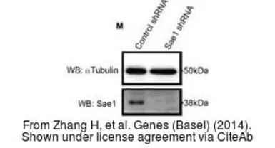 Anti-SAE1 antibody used in Western Blot (WB). GTX113602