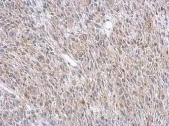 Anti-ASL antibody used in IHC (Paraffin sections) (IHC-P). GTX113629