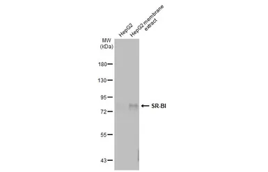 Anti-SR-BI antibody used in Western Blot (WB). GTX113645