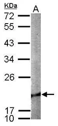 Anti-Cofilin 2 antibody used in Western Blot (WB). GTX113650