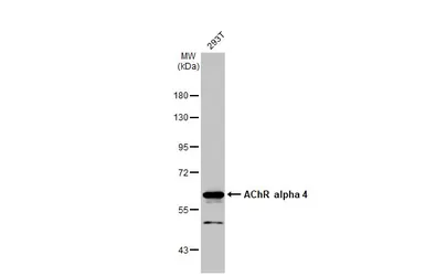 Anti-AChR alpha 4 antibody [N1C1] used in Western Blot (WB). GTX113653