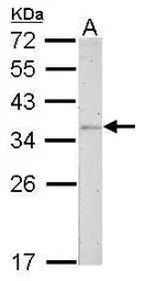 Anti-Fibrillarin antibody used in Western Blot (WB). GTX113684