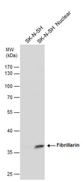 Anti-Fibrillarin antibody used in Western Blot (WB). GTX113684