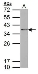 Anti-Fibrillarin antibody used in Western Blot (WB). GTX113684