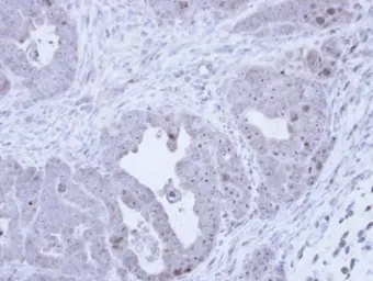 Anti-Fibrillarin antibody used in IHC (Paraffin sections) (IHC-P). GTX113684