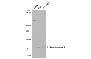 Anti-Laminin gamma 2 antibody [N3C1], Internal used in Western Blot (WB). GTX113765